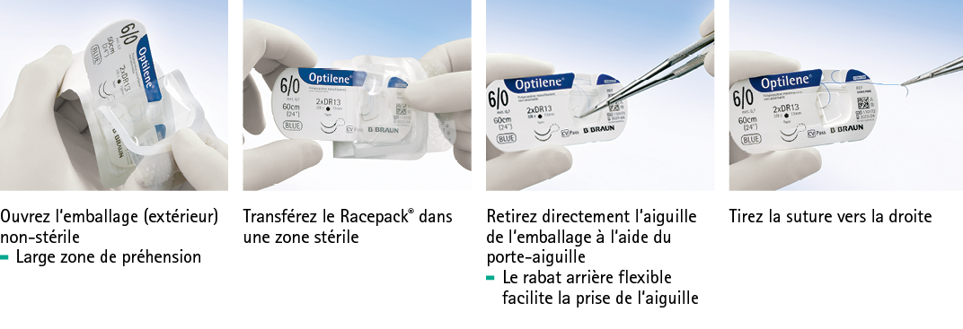 RCP package fr