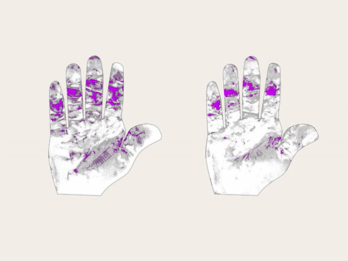 Two illustrations of a hand showing different zones of hand fatigue, highlighted in lila color