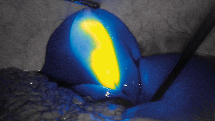 FI-intensiteit – 3D-fluorescentiebeeldvormingstechnologie