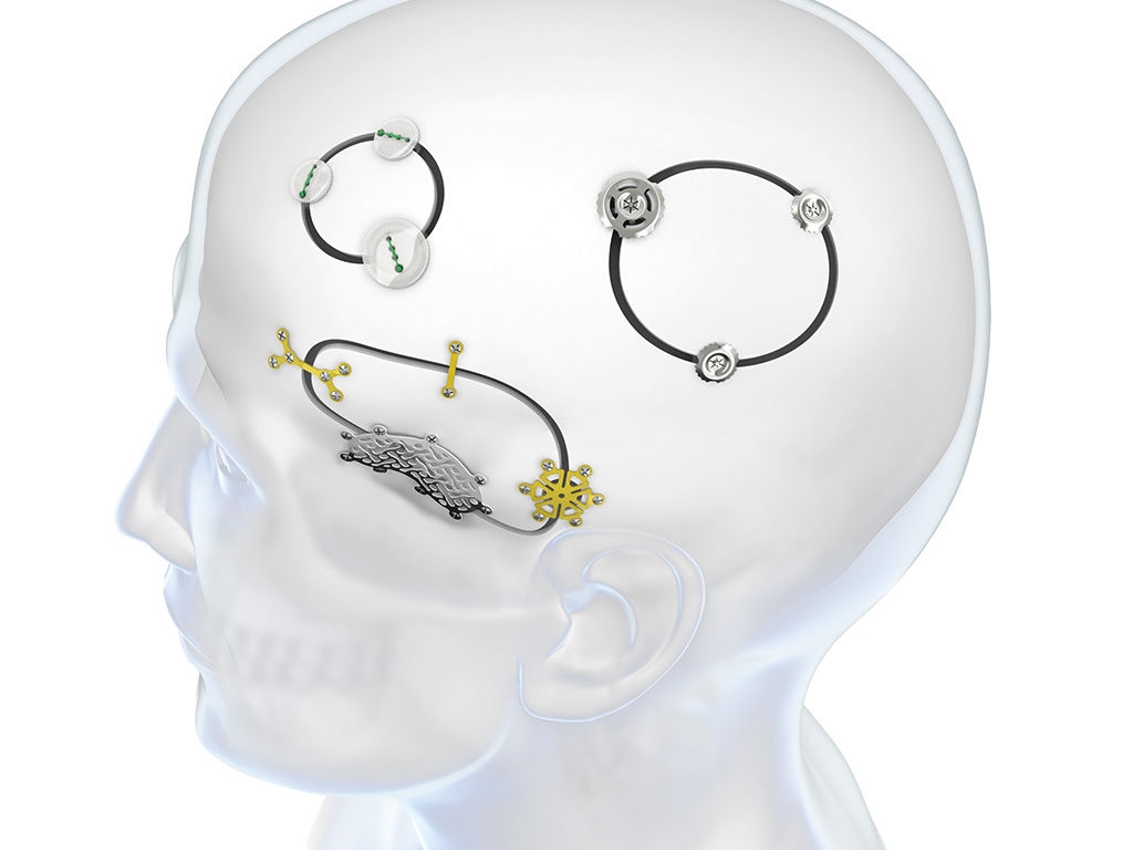 Two illustrations of a hand showing different zones of hand fatigue, highlighted in lila color